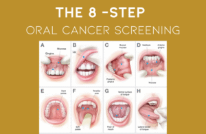 Oral Cancer