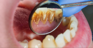 Dental Hygienists