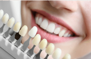 teeth whitening