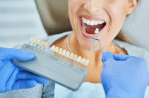  teeth whitening