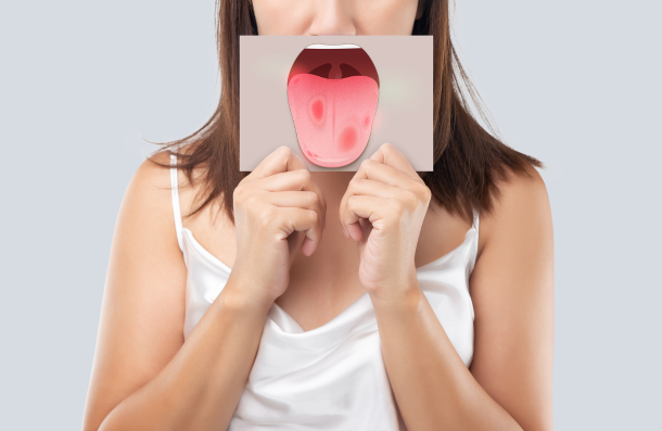 Lady holding up a large photograph of a tongue