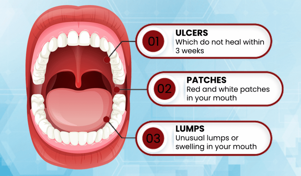 Oral Cancer symptoms image