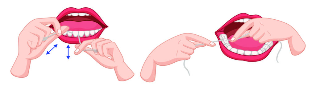 Step-2-of-flossing
