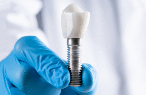 Dental Implants