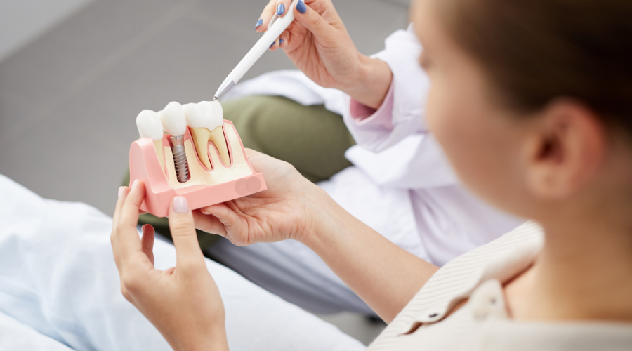 Dental Implants