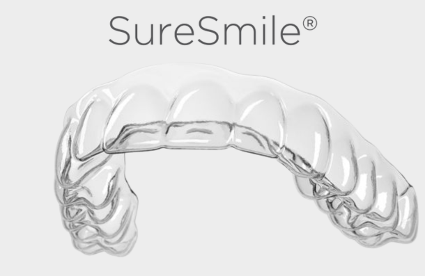 SureSmile Aligners