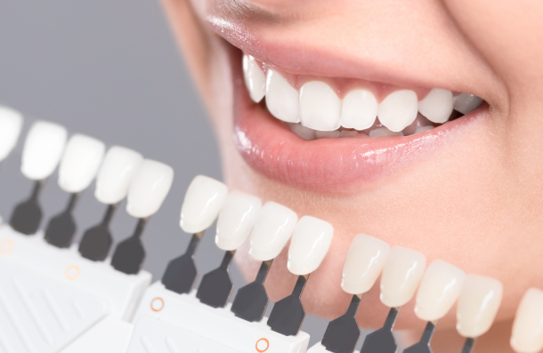 composite bonding