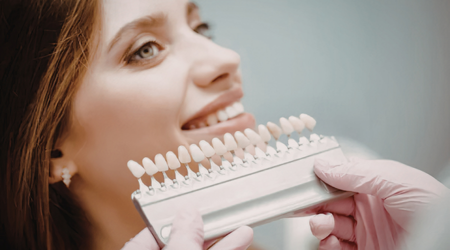 Veneers in Plymouth