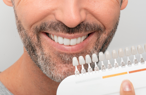 tooth whitening