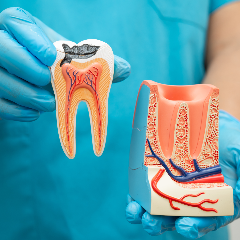 Root Canal Treatment in Plymouth