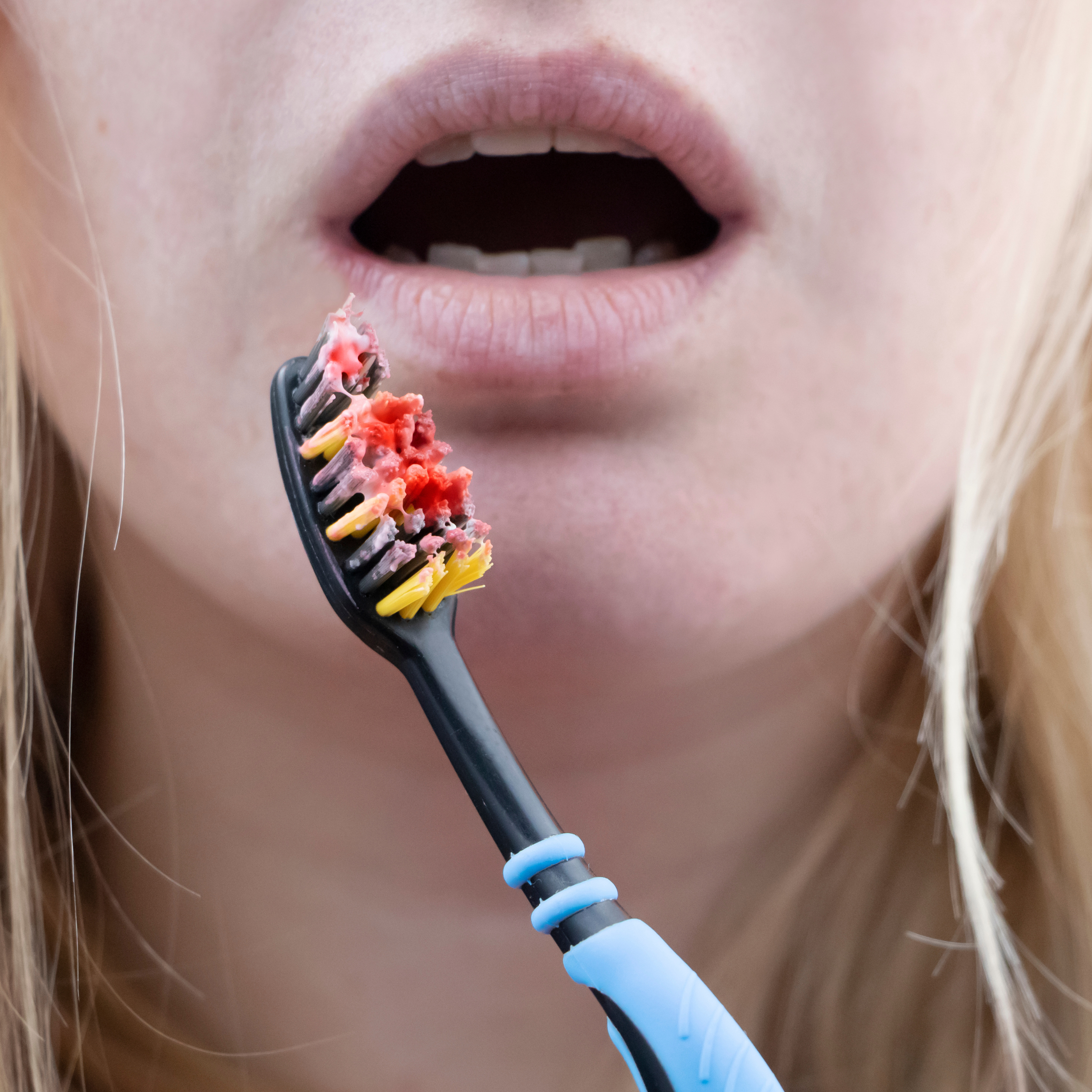 Bleeding gums