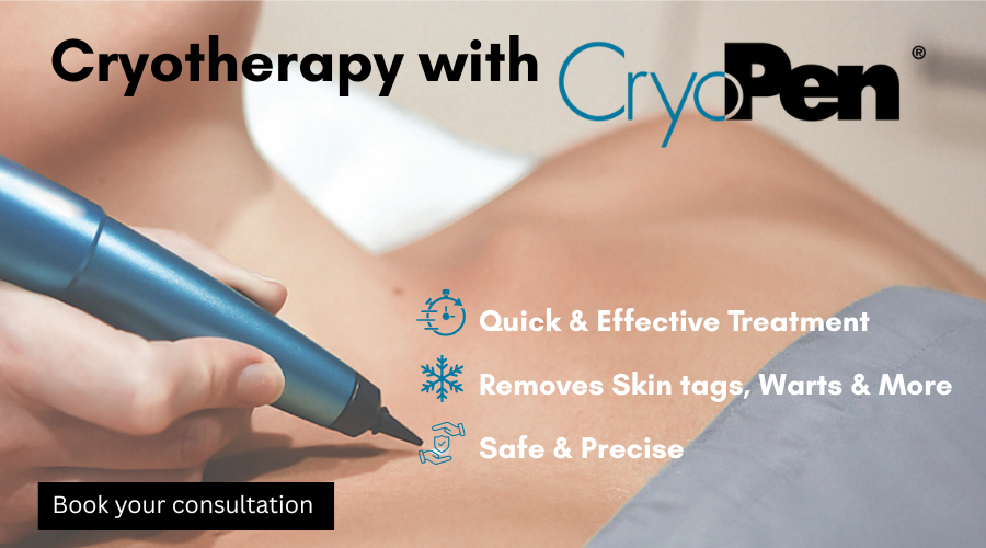 Cryotherapy page topper