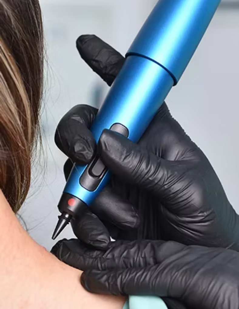 cryotherapy featured image