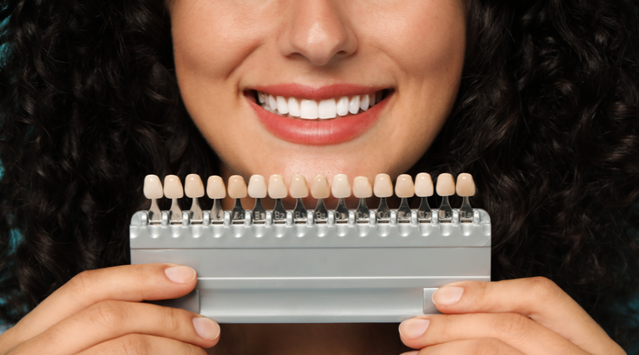 Teeth whitening - Plymouth