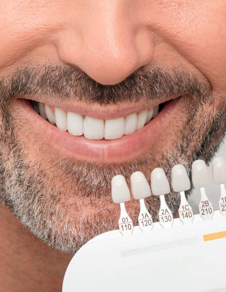 Tooth Whitening in Plymouth