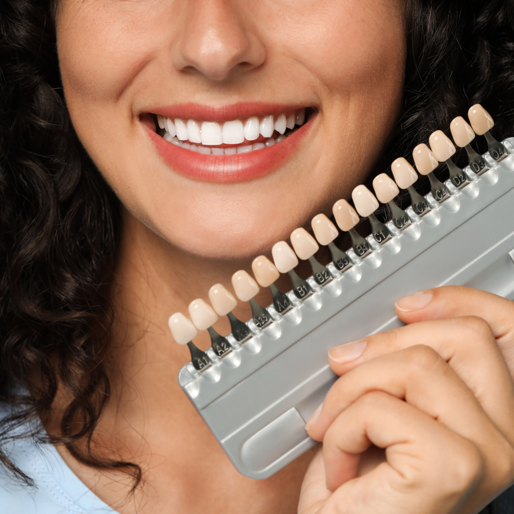 teeth whitening - Plymouth