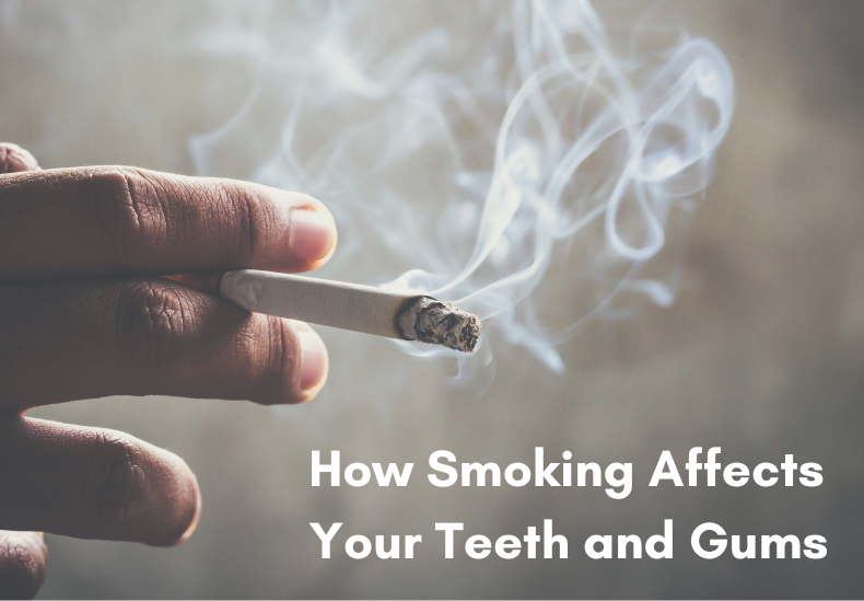 LH blog featured image smoking affects teeth and gums